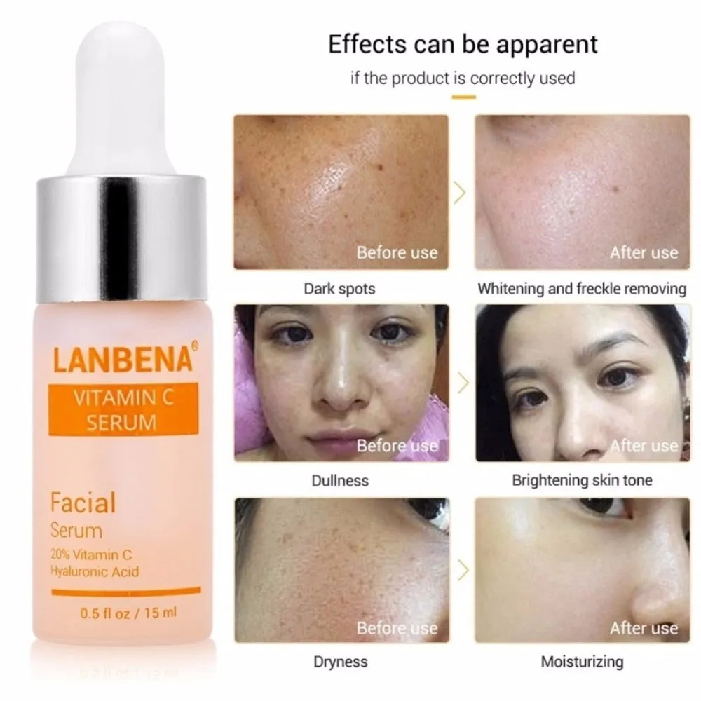 15ml Vitamin C Serum Whitening Serum Hyaluronic Acid Face Cream Remover Freckle Spots Anti-aging Skin Care Essence TSLM2